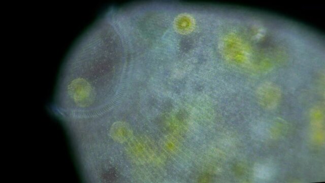 Stentor Ciliophora Infusoria under microscope, order Heterotrichida, feed on small organic residues, bacteria, algae, protozoa. Longitudinal rows of short cilia are visible