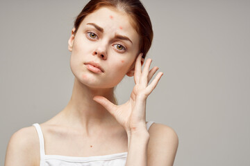 red-haired woman cosmetology skin care puberty isolated background