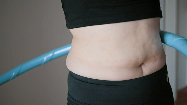 Close up of belly postpartum exercise with hula hoop, Overweight female twirling hula hoop, Fatty woman exercise for weight loss, slimming process, Slow motion