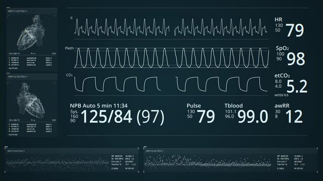 MRI scanning. Dynamic Heart beat line, pulsating heart. Cardiogram signal monitoring process. Patient&rsquo;s vital signs displayed on hospital screen. EKG, ECG curve. Pulse measuring. Medical 4K animation