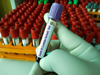 Adenomatours polyp. A polyp which can turn into colon cancer. Such polyps are considered pre-cancerous. Almost all colorectal tumors start from adenomatous polyps. Colonic Polyp.