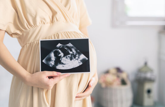 妊婦イメージ　マタニティフォト