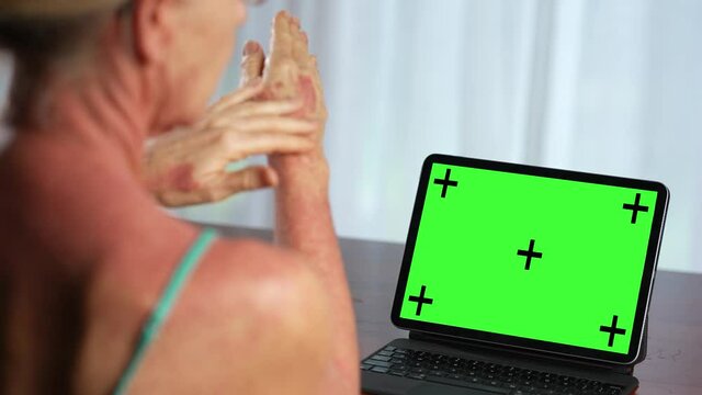 Woman with skin rash hives on neck and hands on telemedicine call on tablet computer with green screen.