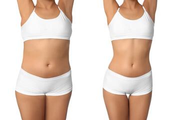 Collage with photos of woman before and after weight loss diet on white background, closeup - obrazy, fototapety, plakaty