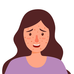 Woman with itching face in flat design on white background. Allergy skin. Acne facial skin problem.