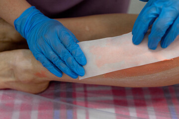 The stage of the epilation procedure.Removal of unwanted hair on the legs.The master removes the wax with the help of special bandage strips for depilation.Orange wax is applied to the legs.