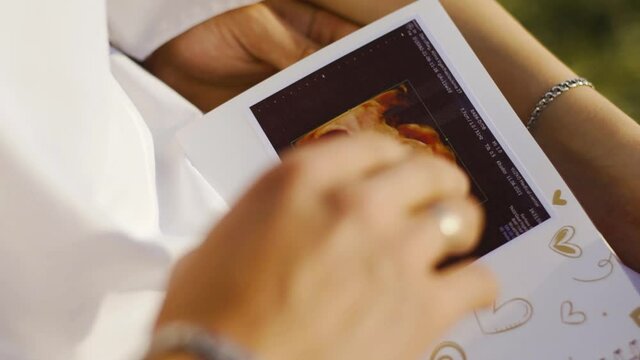 Parents examine a color ultrasound image of a small child in the womb. Maternal and paternal love for the unborn baby. Modern technologies of pregnancy management