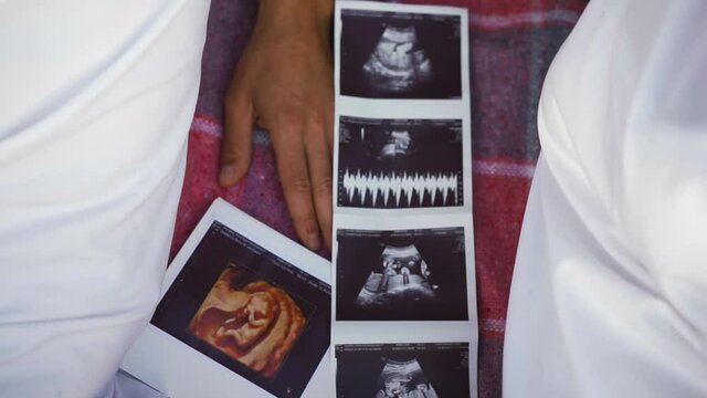 Husband and wife lying on the bedspread and between them an ultrasound image of the baby, the fetus. Parents expecting a newborn and being examined did a scan of the woman's abdomen