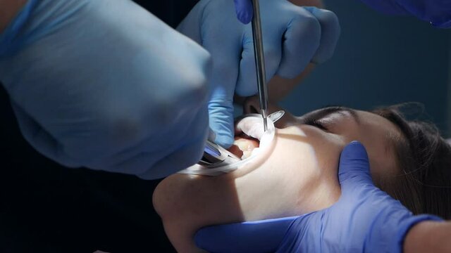 Dentist using surgical pliers to extract a tooth in the dental office. Extracted wisdom tooth covered in blood