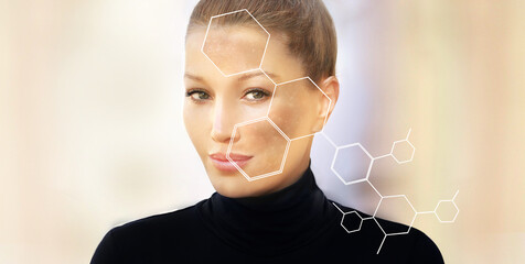 Dark spots, freckles,hyperpigmentation(melasma or chloasma),concept - skin lightening, skin...