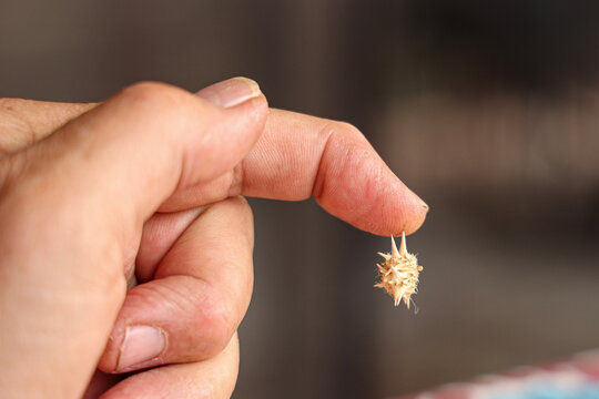 Goatheads in finger