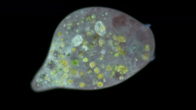 Stentor Ciliophora Infusoria under microscope, family Stentoridae, class Ciliata, order Heterotrichida, feed on small organic residues, bacteria, algae, protozoa.