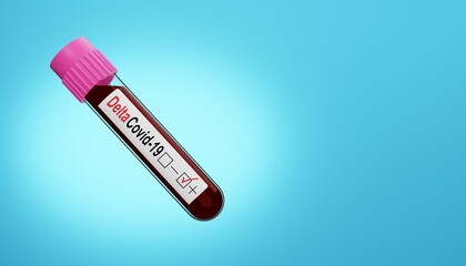 3D render of the coronavirus and a positive test of the Delta covid-19 variant. Medical concept for the outbreak of the life-threatening Covid-19 virus. Illustration of a digital image for medicine.