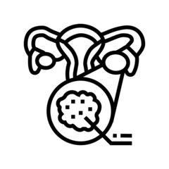 polycystic ovary syndrome endocrinology line icon vector. polycystic ovary syndrome endocrinology sign. isolated contour symbol black illustration