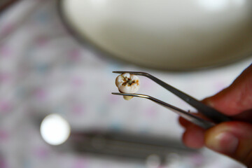 Extracted tooth in tweezers against background of dental instruments