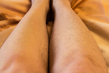 Image before and after Legs hairs removal concept.