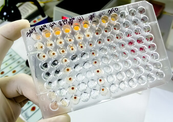 Hemagglutination assay for T. pallidum antibodies. TPHA. ELISA plate, serology testing method in medical laboratory