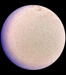 Sperm morphology. Semen photo under microscope. Micrograph showing spermatozoon