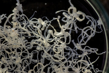 The study parasite or worms is a freshwater fish parasite in laboratory for education.
