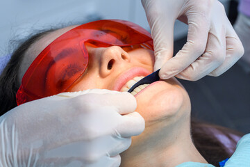 dental articulating paper, Process of removing dental braces from a Caucasian girl in a dental...