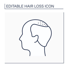 Hair loss line icon. Man loses hair. Male pattern baldness. Large bald area on frontal and central scalp. Alopecia concept. Isolated vector illustration. Editable stroke