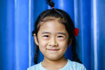 Little girl eyelid swelling pain or virus injury. Asian children allergy irritation, healthcare concept.