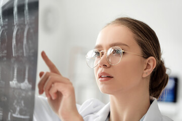 Female doctor with x-ray scan in clinic