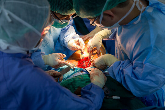 Shot of emergency and serious accident. Medical Team Performing Surgical Operation in Modern Operating Room. Medical team performing surgery in hospital. Group of surgeon at work in operation theater.