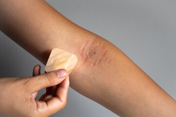 Young woman removing medical patch against gray background, close up