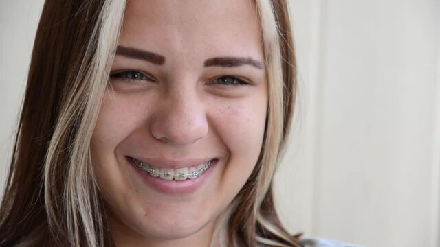 Young woman is disgusted. Brunette teen girl in dental braces. Beautiful caucasian young girl with green eyes thinking of something abhorrence. Teenage concept. Tooth alignment with braces.