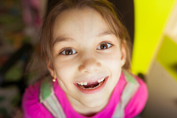 A small beautiful girl without front baby teeth looks at the camera in close-up and smiles.