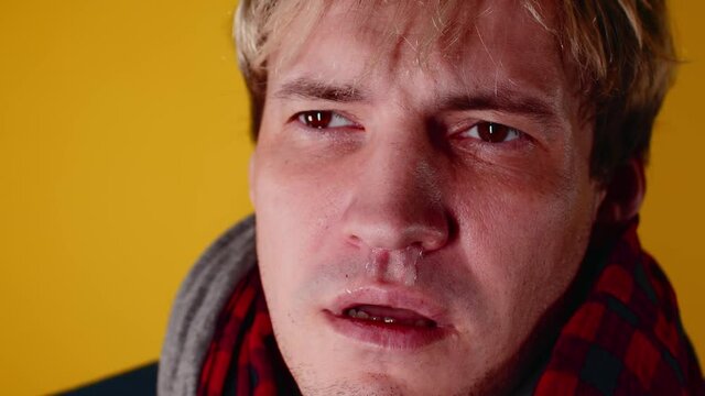 The man has a runny nose. Snot flows from the nose. A man has a cold, he has a runny nose