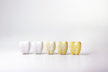 Discoloration healthy teeth from whitening teeth to yellow teeth, When is your oral health bad The...