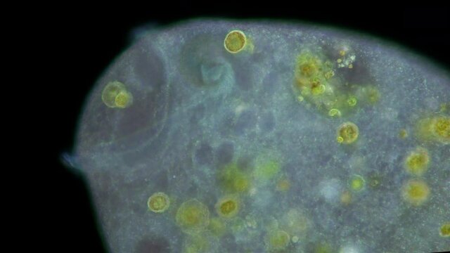 Stentor Ciliophora Infusoria under microscope, family Stentoridae, class Ciliata, order Heterotrichida, feed on small organic residues, bacteria, algae, protozoa.