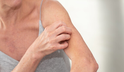 Woman having itchy and scratching her arm