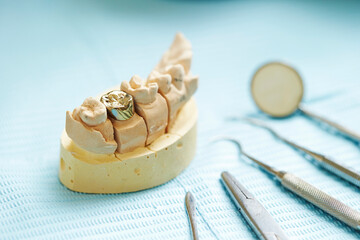 Dental prostheses and dental tools 