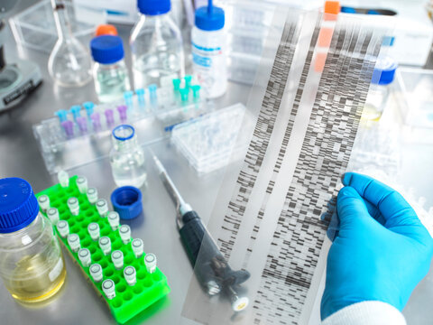 Scientist holding DNA gel sample in laboratory