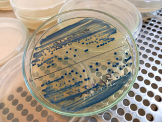 Enterobacter colonies, Gram negative bacilli colonies as test on Chomogenic UTI Agar plate.