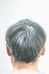Obraz premium Gray hair problems in men. Hair Dye Product Concept.