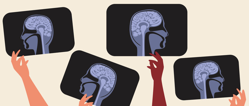 Mri brain scans, flat vector stock illustration with concept of computer tomogram or MRI, doctor's hand with x-ray
