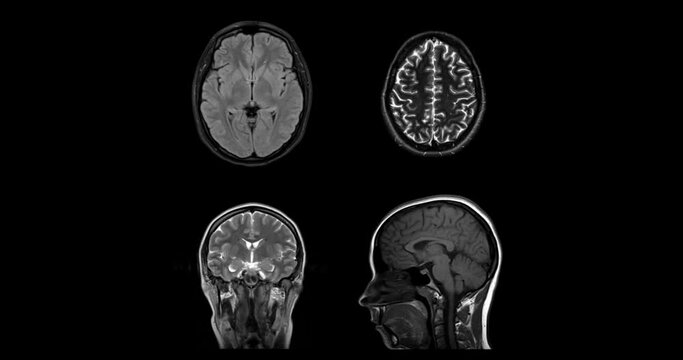 MRI of the brain in different projections. Horizontal, vertical, lateral and top view. MRI brain scanning animation. Magnetic resonance imaging is a medical imaging technique used in radiology.