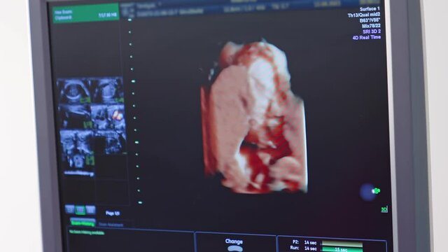 Pictures of fetus on the screen of monitor. Scientific analysis. Ultrasonography of pregnant woman. Ultrasound monitor displaying a small baby in pregnant woman's belly.