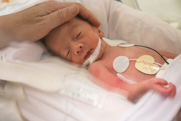 Premature newborn baby in incubator