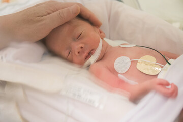 Premature newborn baby in incubator (Soft) - obrazy, fototapety, plakaty