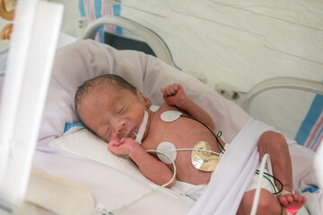 Premature newborn baby in incubator (Soft)
