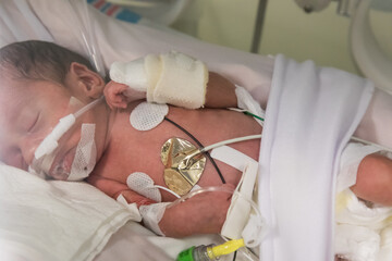 Premature newborn baby in incubator - obrazy, fototapety, plakaty