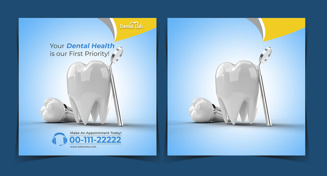 Dental Implants Surgery Concept Instagram Post Banner Template.