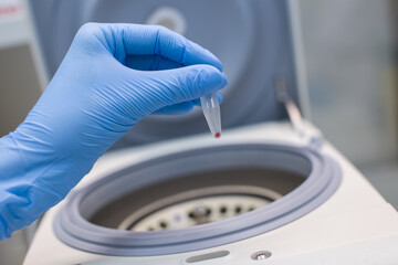 Laboratory technician isolates blood cells