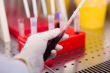 Laboratory technician isolates blood cells