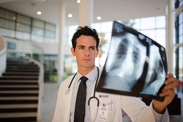 Doctor viewing chest x-rays in hospital